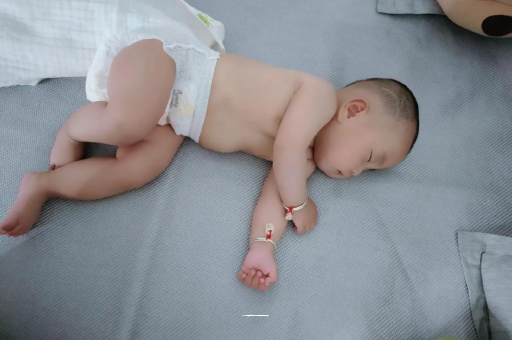 伊犁哈萨克六个月宝宝眼睛散光